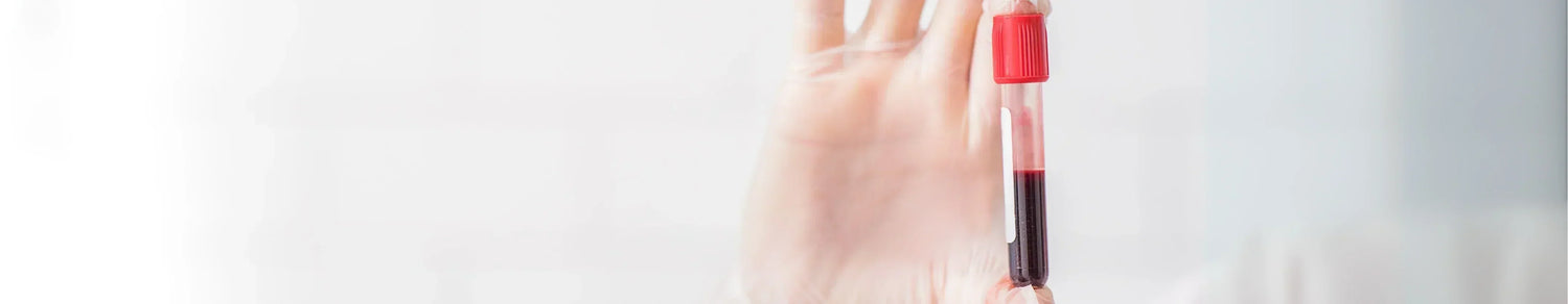 Top Longevity Biomarkers, Inflammatory Markers, Gut Microbiome Diversity, Lipids Profiles, Blood Sugar