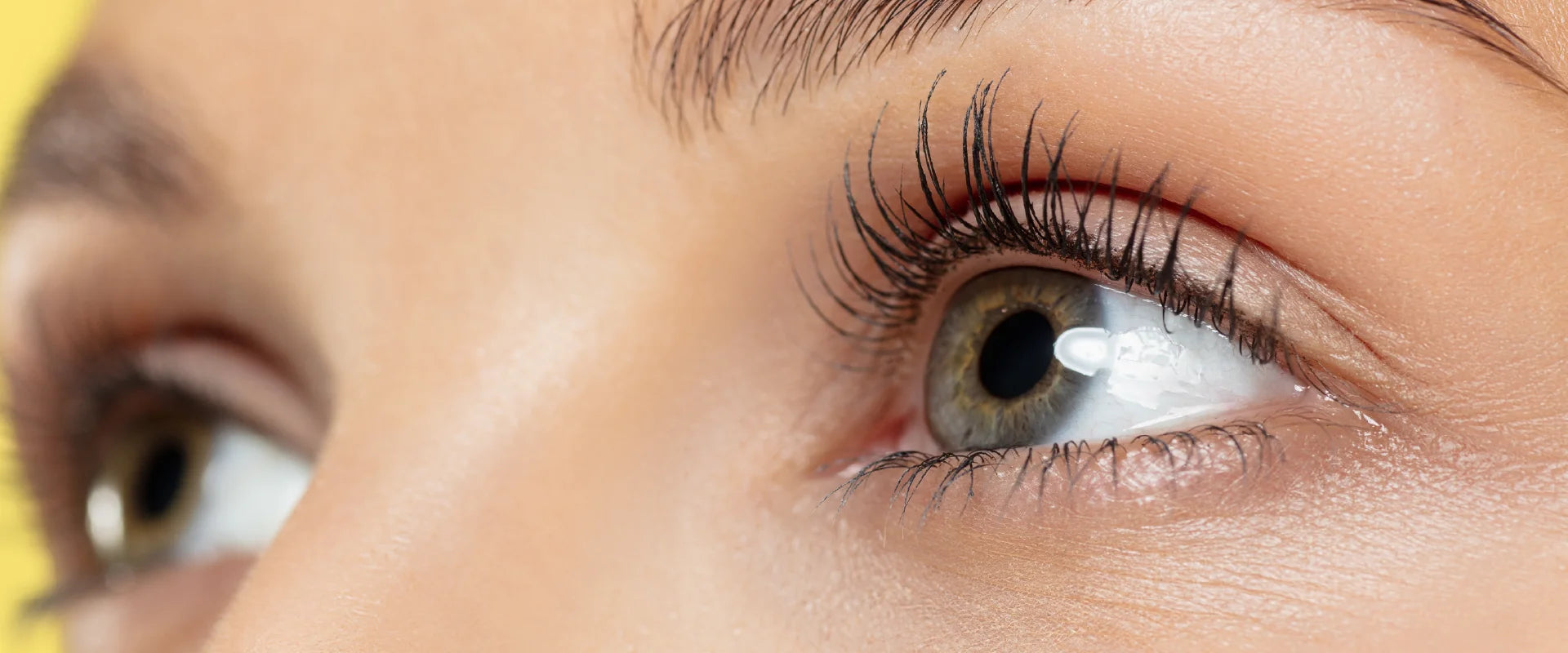 Tips for Eye flu treatment at home
