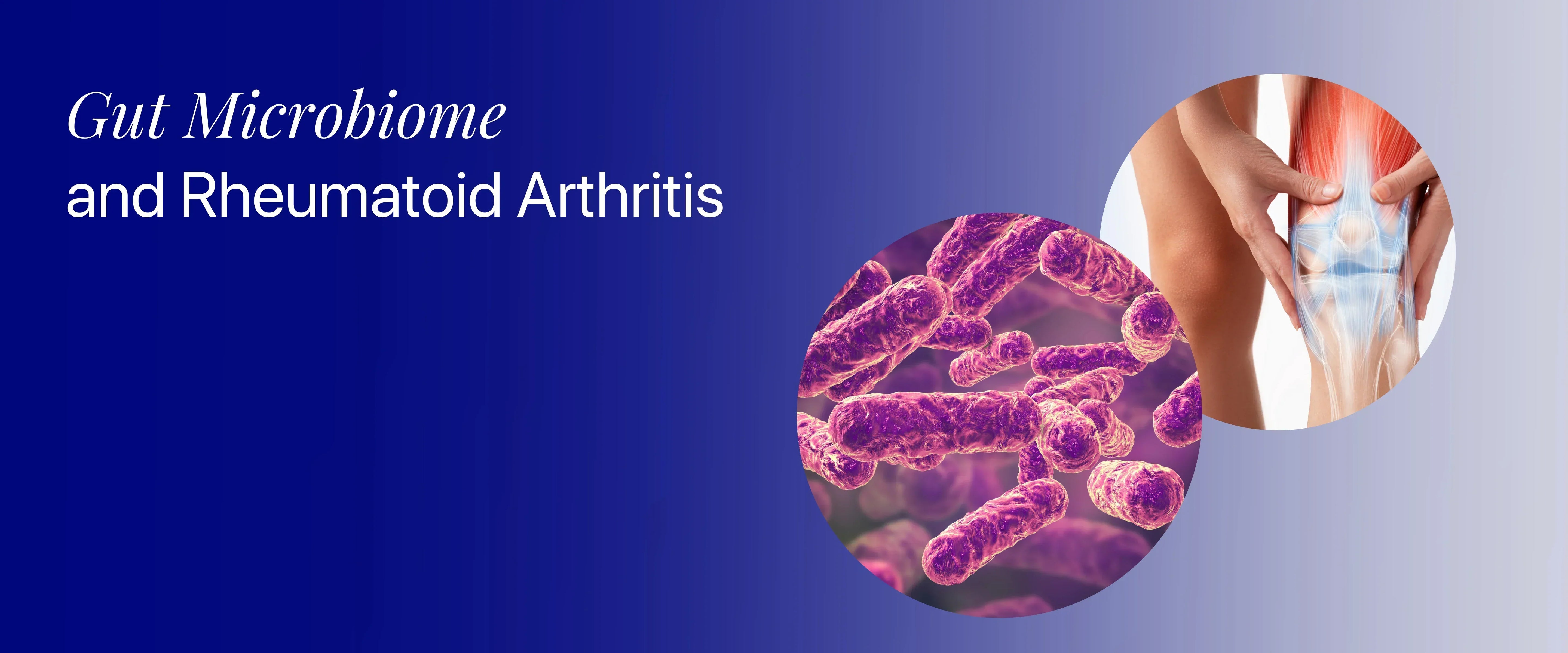 rheumethoid arthritis and gut microbiome effect 